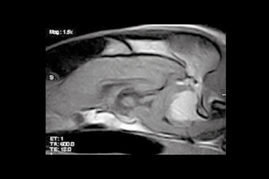 Kernspintomographie (MRT) - Bild 1